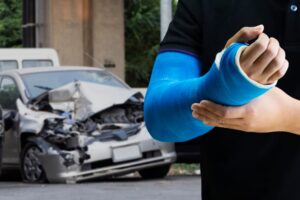 A man's broken arm after car accident